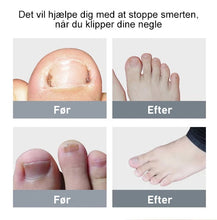 Indlæs billede til gallerivisning 304 rustfrit stål negleklipper sæt