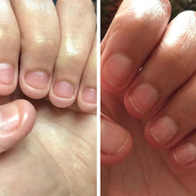 Indlæs billede til gallerivisning Nærende negleoliepen