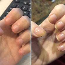 Indlæs billede til gallerivisning Nærende negleoliepen