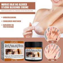 Indlæs billede til gallerivisning Kraftig blegecreme til mørke knæ og albuer