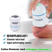 Indlæs billede til gallerivisning Fodfil og callusfjerner