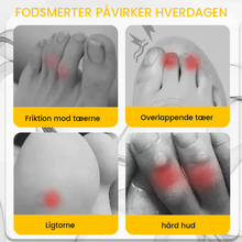 Indlæs billede til gallerivisning anti-friktions tåbeskytter i silikone