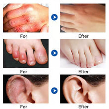 Indlæs billede til gallerivisning Speciel fugtighedscreme mod forfrysninger og sprækker