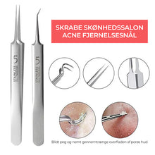 Indlæs billede til gallerivisning Professionelt pincetsæt til fjernelse af hudorme