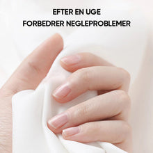 Indlæs billede til gallerivisning Nærende negleoliepen