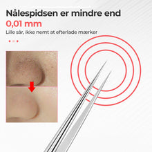 Indlæs billede til gallerivisning Professionelt pincetsæt til fjernelse af hudorme