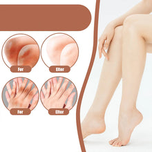 Indlæs billede til gallerivisning Kraftig blegecreme til mørke knæ og albuer