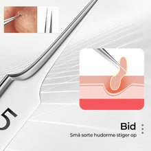 Indlæs billede til gallerivisning Professionelt pincetsæt til fjernelse af hudorme