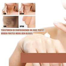 Indlæs billede til gallerivisning Kraftig blegecreme til mørke knæ og albuer