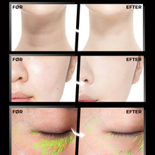 Indlæs billede til gallerivisning Løftende og opstrammende Massageapparat med sonisk vibration