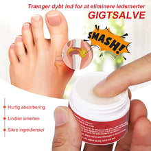 Indlæs billede til gallerivisning Afslapningscreme til knyster