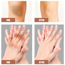 Indlæs billede til gallerivisning Kraftig blegecreme til mørke knæ og albuer