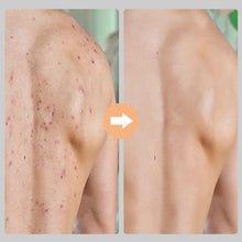 Indlæs billede til gallerivisning Smart eksfolierende handske