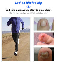 Indlæs billede til gallerivisning 304 rustfrit stål negleklipper sæt