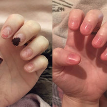 Indlæs billede til gallerivisning Nærende negleoliepen