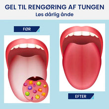Indlæs billede til gallerivisning Tungerensnings-gel sæt
