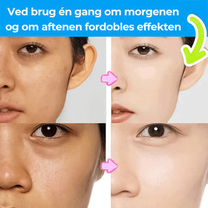 Southern Xiehe Niacinamide blegende ansigtsrens
