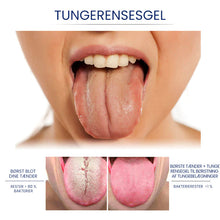 Indlæs billede til gallerivisning Tungerensnings-gel sæt
