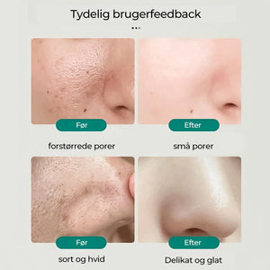 Southern Xiehe Niacinamide blegende ansigtsrens